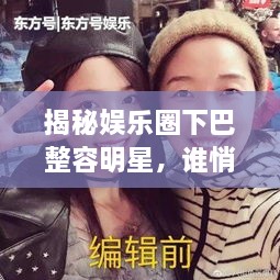 揭秘娛樂圈下巴整容明星，誰悄悄整過下巴？