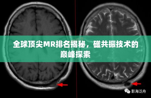 全球頂尖MR排名揭秘，磁共振技術(shù)的巔峰探索