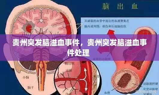 貴州突發(fā)腦溢血事件，貴州突發(fā)腦溢血事件處理 